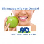 Balnqueamiento-Dental-Centro-Medico-Dental-Aquitania