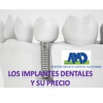 Implantes-dentales-precio-Aquitania